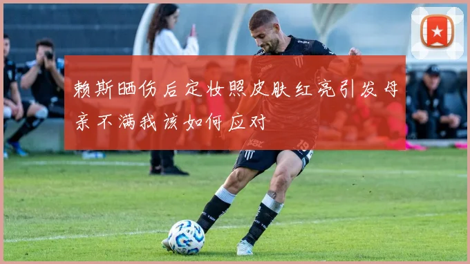 赖斯晒伤后定妆照皮肤红亮引发母亲不满我该如何应对